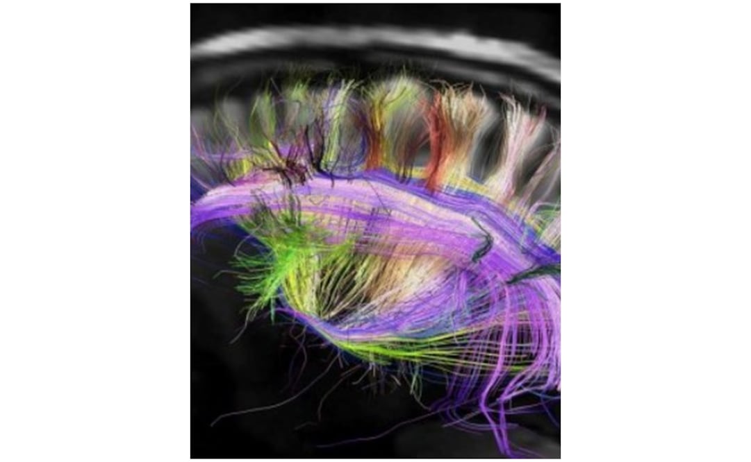 Los científicos extrajeron el ARN del sistema nervioso de los caracoles marinos que recibieron los choques. Foto: Archivo