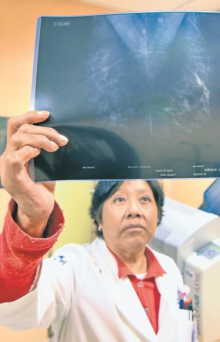 La prevalencia del cáncer de mama no ha bajado: OMS. Foto: ARCHIVO EL UNIVERSAL