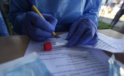 CDMX adquirirá pruebas rápidas de Covid-19