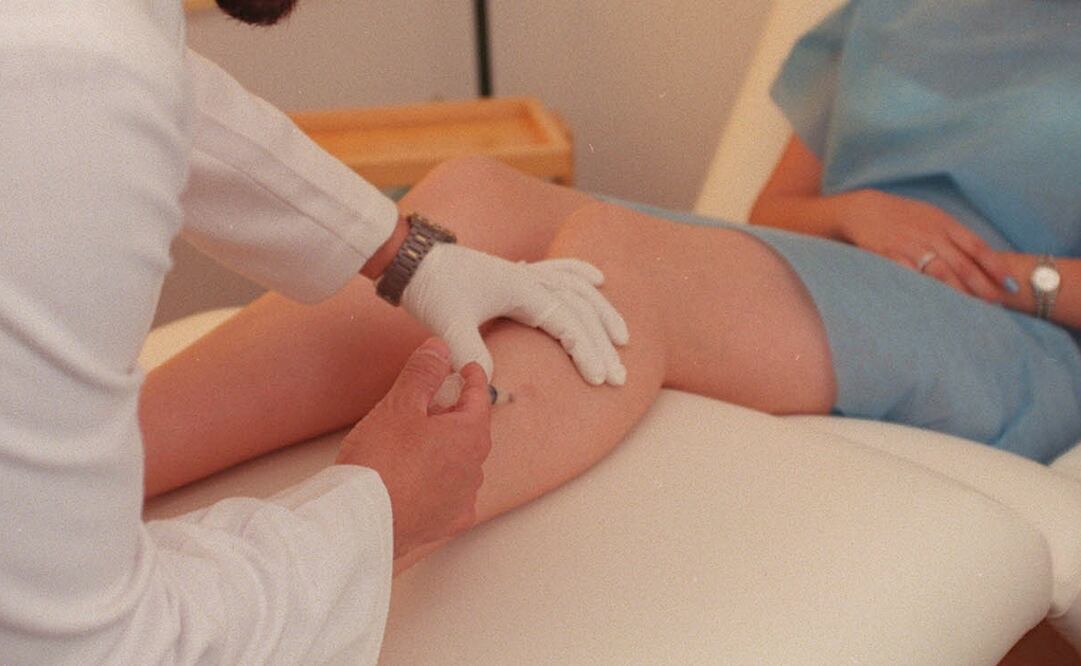 Foto ilustrativa. Archivo// EL UNIVERSAL 