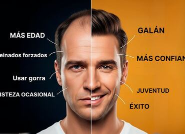 Contra la alopecia: Guía para recuperar el cabello en 2025