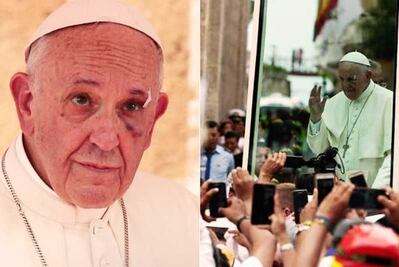 Papa Francisco se golpea el rostro en papamóvil en Colombia