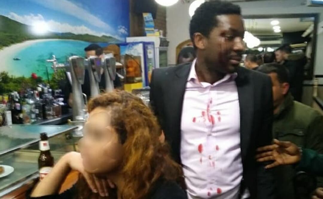 Luego de amenazar a Makon, la mujer tomó una botella y agredió con ésta al actor. (Foto: tomada de Facebook)