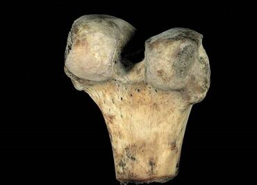 Con ceniza de cáscara de arroz, UNAM desarrolla sustitutos óseos