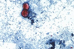 México activa vigilancia epidemiológica por Cyclospora tras confirmar 33 casos; síntomas y cómo se contagia
