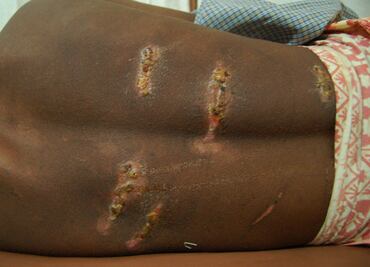 Rohingya crisis: Myanmar army deserters confirm atrocities against minority in video testimony