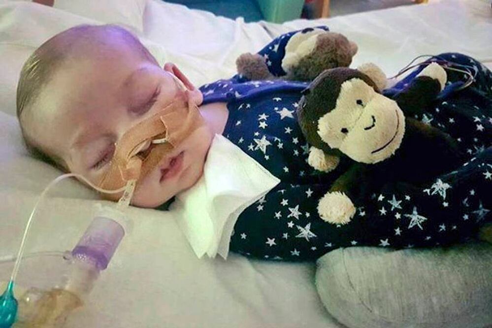 Charlie Gard, el niño británico, cuya historia conmovió al mundo. Foto: Family of Charlie Gard vía AP