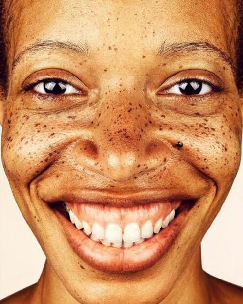 Este fotógrafo retrata a personas con pecas y se viraliza