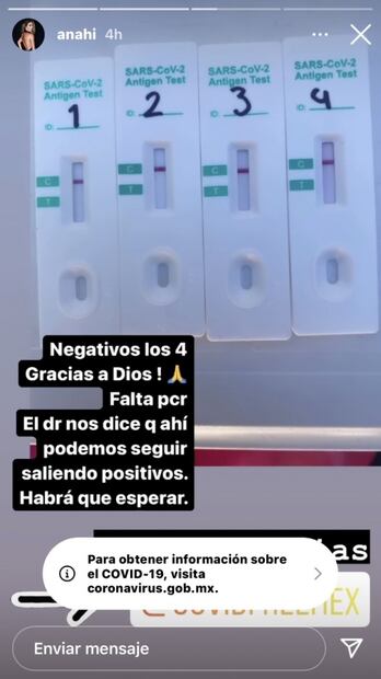 "Me contagié de Covid en el concierto tributo a RBD": Anahí 