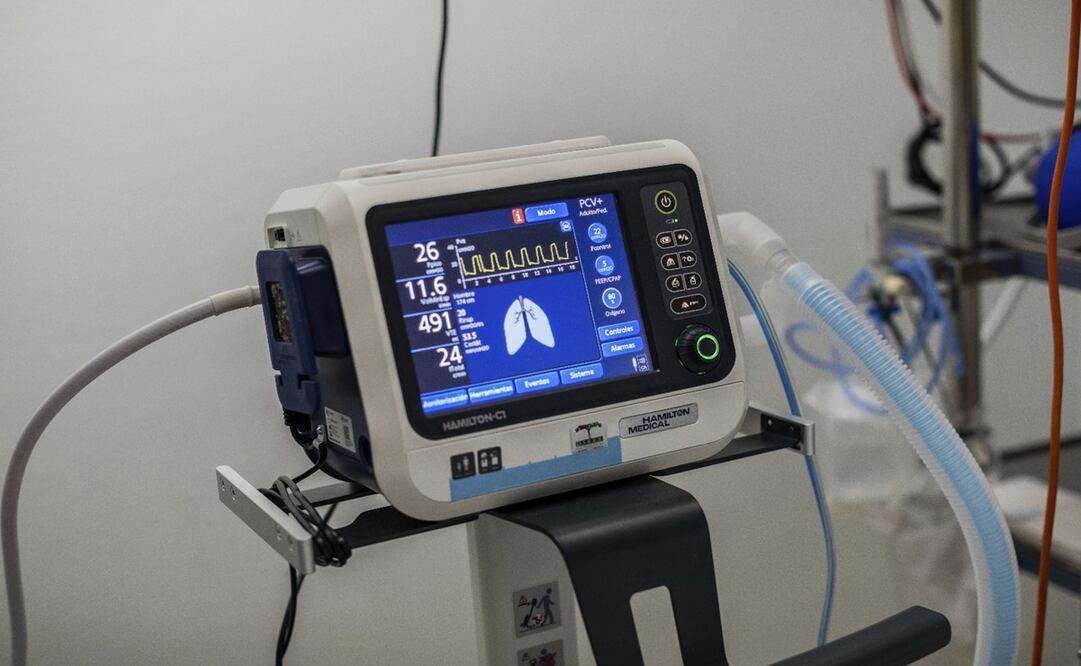 Detalle de un ventilador conectado a un paciente infectado por COVID-19 en una de las unidades de cuidados intensivos del hospital Severo Ochoa en Leganés, en las afueras de Madrid, España - Foto: Bernat Armangue/AP
