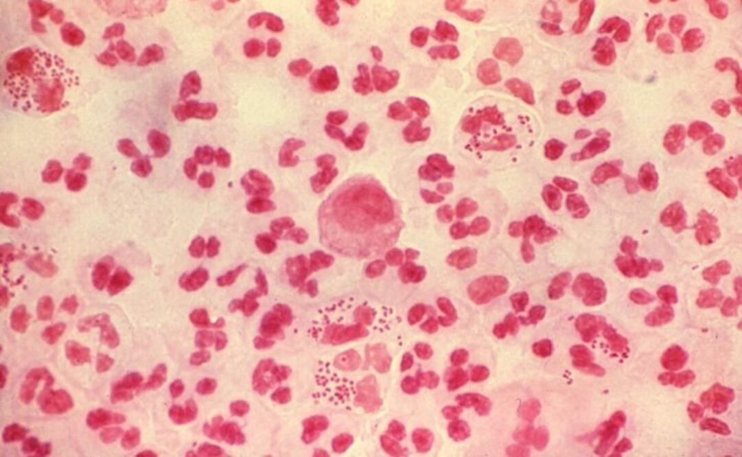 Gonococos, las bacterias responsables de la gonorrea/Foto: Archivo