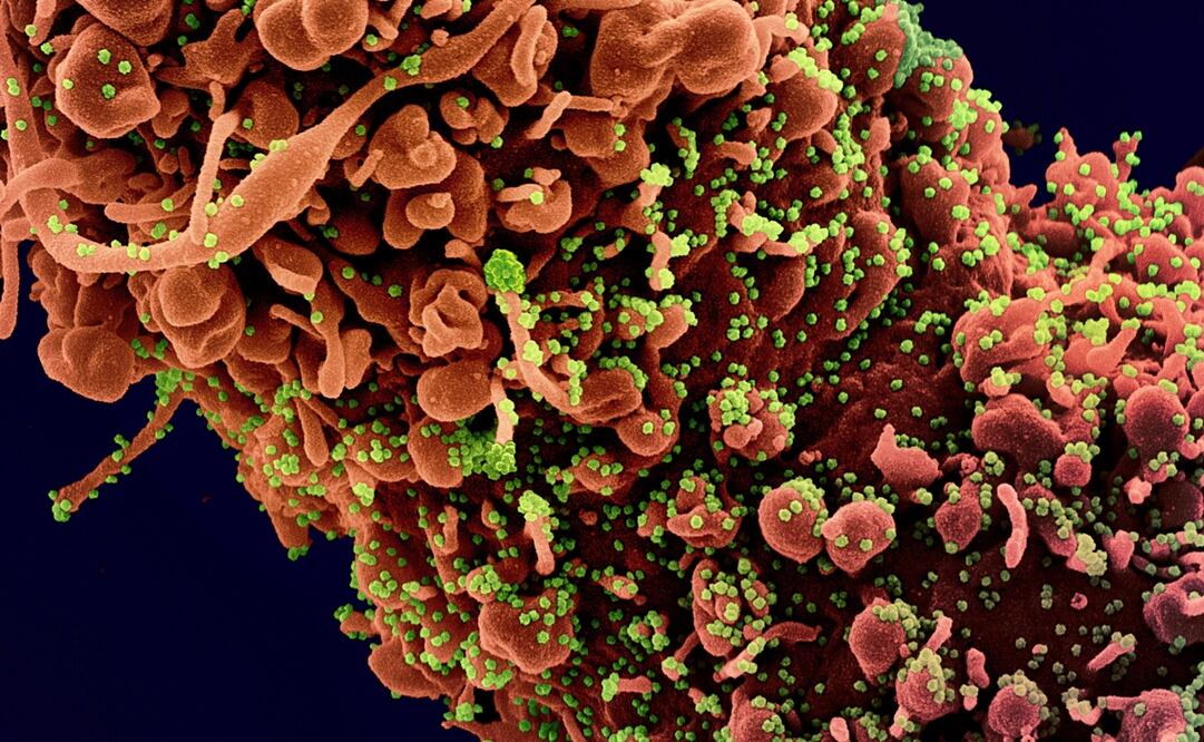 Foto: EFE/EPA/NIAID/NATIONAL INSTITUTES OF HEALTH 