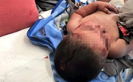 Pitbull ataca a niño de dos años y a un adulto en Zapopan