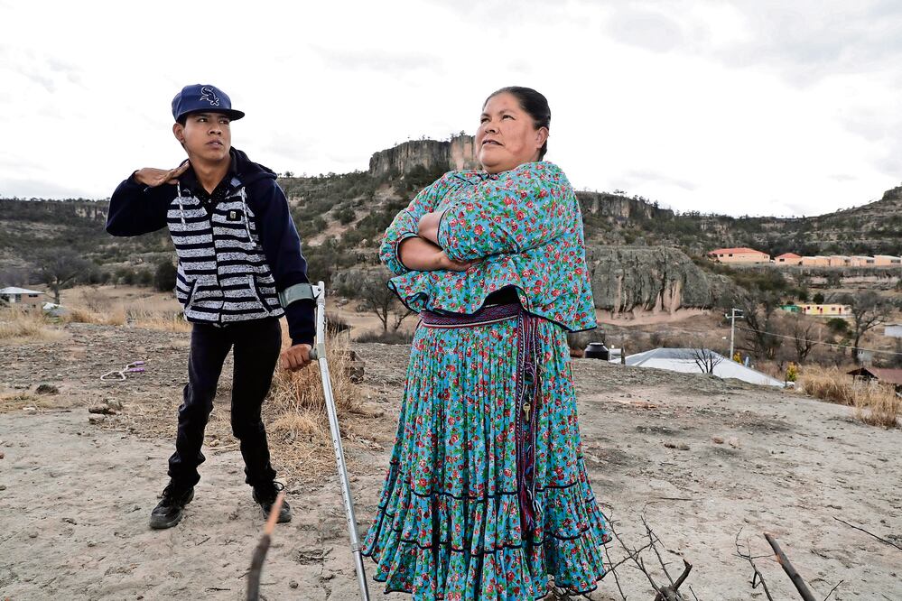 Genaro González Bustillo usa una muleta de metal para apoyarse. Su mamá Maribel González dice que para motivar a su hijo a que se quedara en el pueblo lo llevó a la tienda en la que trabaja casi 10 horas, pero señala que no le agradó (LUIS CORTÉS)