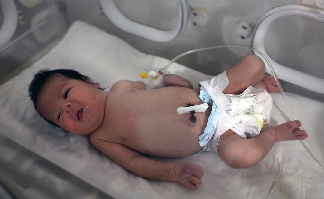 Una niña que nació bajo los escombros causados por un terremoto que sacudió Siria y Turquía recibe tratamiento dentro de una incubadora en un hospital infantil en la ciudad de Afrin. Foto: AP