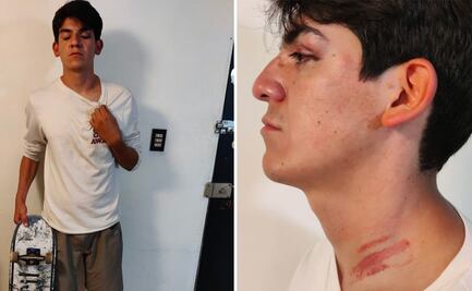 Policías detienen y golpean a dos jóvenes en Tulancingo, Hidalgo; alcalde promete investigación