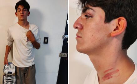 Policías detienen y golpean a dos jóvenes en Tulancingo, Hidalgo; alcalde promete investigación