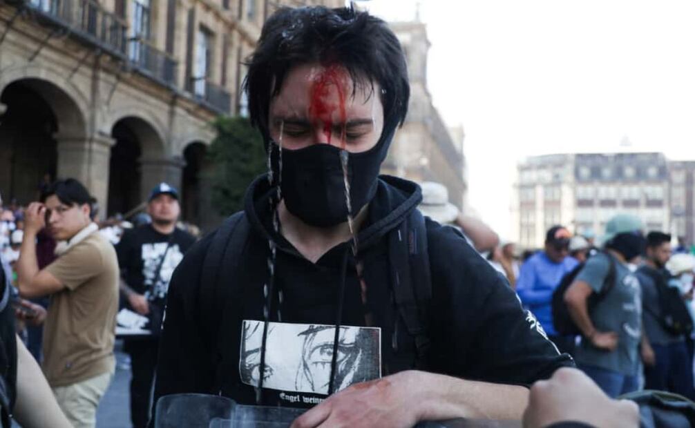 Lesionados durante la marcha de la generación Z y en apoyo a Carlos Manzo (15/11/2025). Foto: Carlos Mejía/EL UNIVERSAL