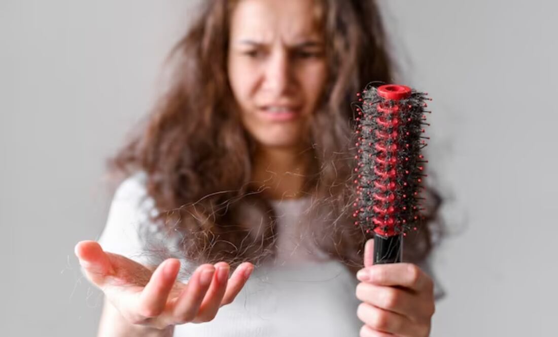 Caída de cabello estrés. Fuente: Freepik