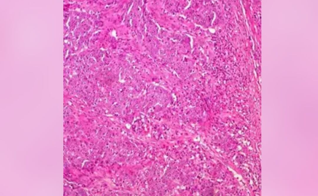 Foto: UCM, archivo vía Europa Press