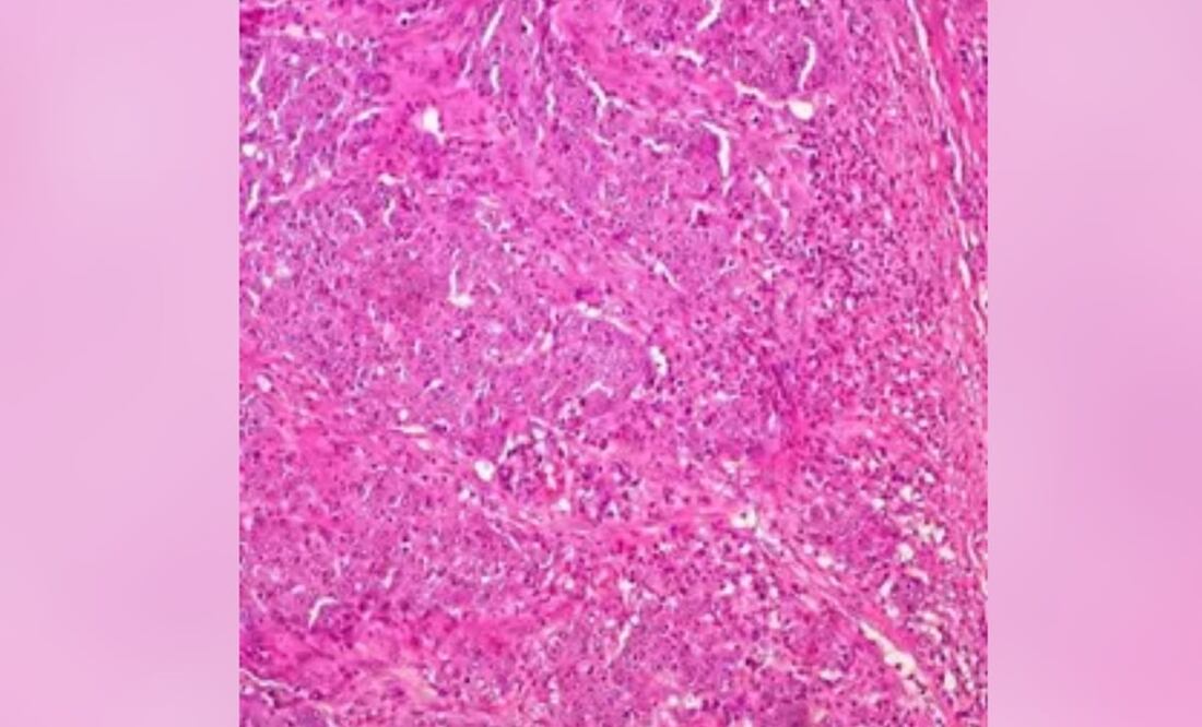 Foto: UCM, archivo vía Europa Press