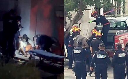 Joven atacado por pitbulls en Yucatán pierde el brazo por las lesiones