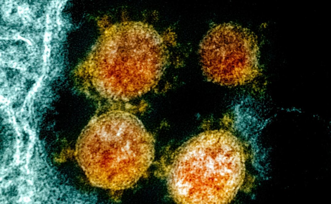 Foto: NIAID/National Institutes of Health via AP