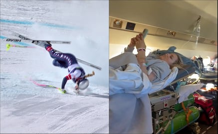 Lindsey Vonn dice que casi deben amputarle una pierna tras su accidente en Milán-Cortina