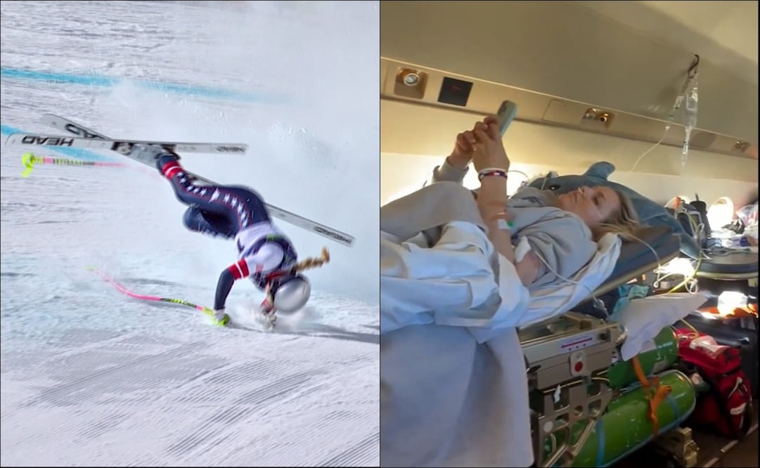 Lindsey Vonn compartió detalles de su lesión / Foto: Especiales