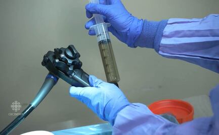 Polémica en Canadá por tratamiento de autismo en México con transplante fecal