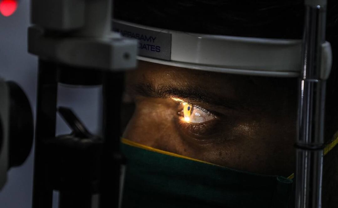 Hombre se somete a un control ante la sospecha de estar infectado con mucormicosis. Foto: EFE