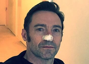 Hugh Jackman de nueva cuenta recibe tratamiento contra cáncer