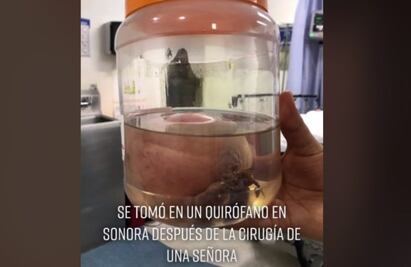 ¡Qué miedo! Se aparece "La Muerte" en un quirófano de Hermosillo, Sonora