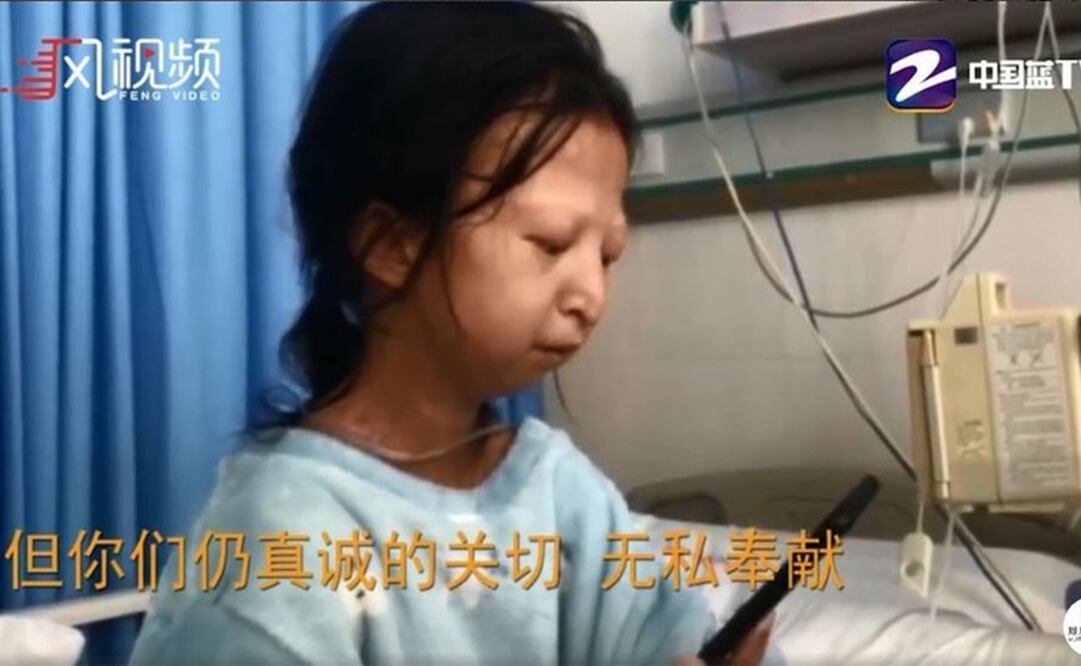 Cuando Wu Huayan fue internada en el hospital, pesaba poco más de 20 kilos. Foto: Captura de pantalla 