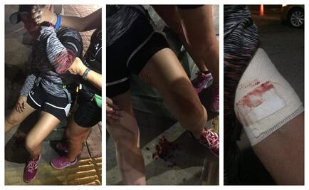 Perro ataca a mujer en el malecón de La Paz, Baja California Sur