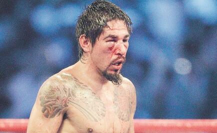 Margarito debe firmar responsiva