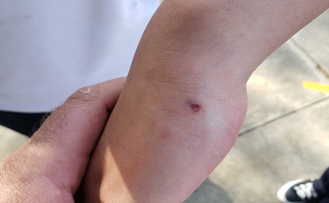 Niños de escuela primaria en Pátzcuaro, Michoacán, son atacados por un perro. Foto: Especial