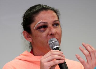 PGR pide videos de agresión a Ana Guevara