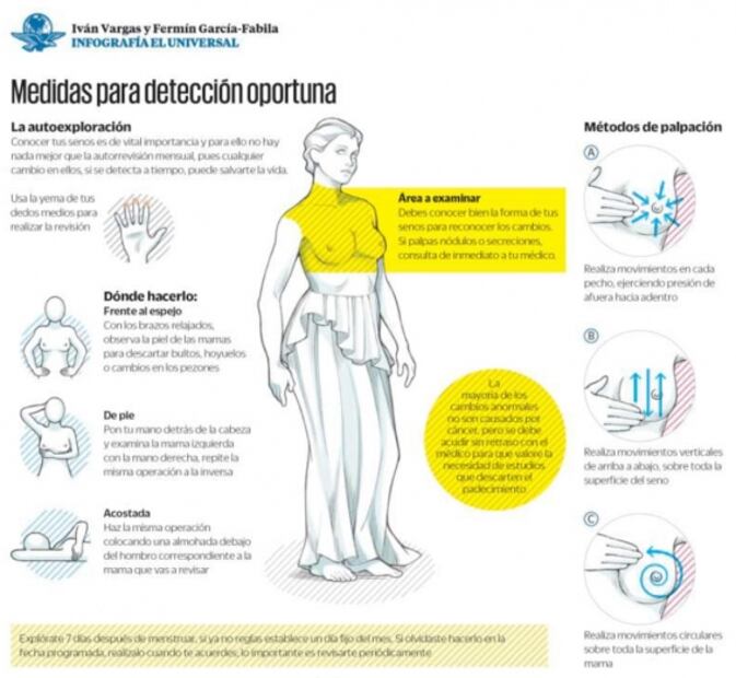 Cáncer de mama. Lorena muestra su cicatriz para invitar a las mujeres a que se exploren