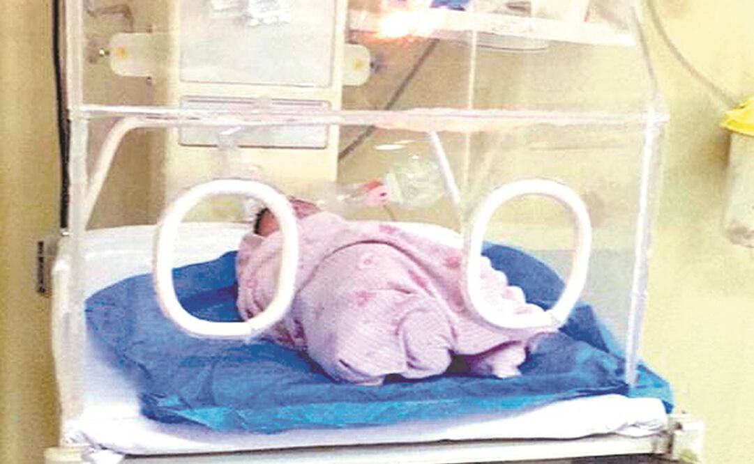 Los recién nacidos se mantuvieron bajo vigilancia epidemiológica y sólo uno tuvo que ser intubado. Foto: Especial.