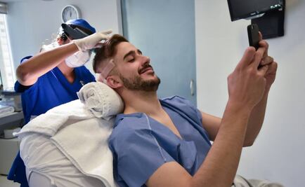 ¡Adiós a los problemas de la calvicie!