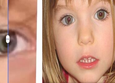 Madeleine McCann y la rara condición en el ojo que comparten la niña y la joven polaca