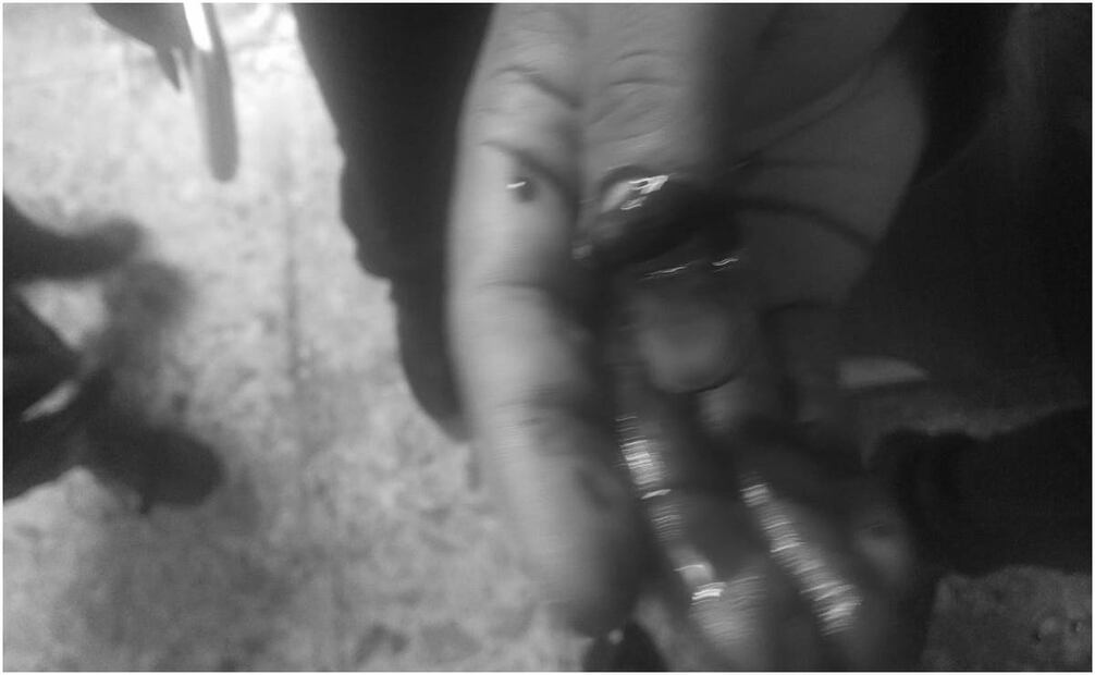 Mutilado en el Metro. Foto: Especial