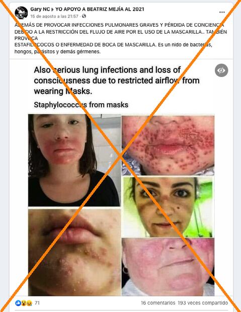 ¿Cubrebocas contra el Covid pueden causar enfermedades en la piel? 