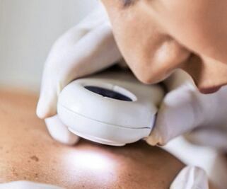 Disminuye presencia de lepra en México; en 2018, sólo 388 casos