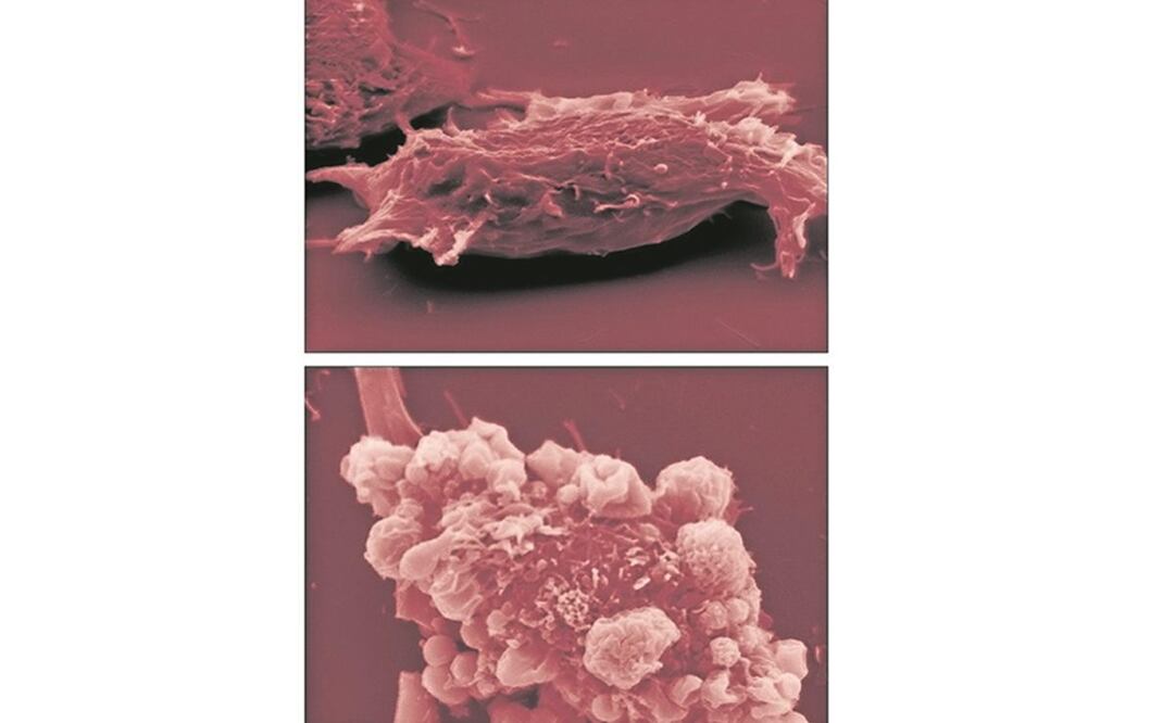 Composición de imágenes microscópicas de células cancerígenas. Foto: Archivo. El Universal
