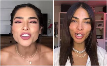 FOTOS: Rostro de Alejandra Espinoza da de qué hablar: la actriz afronta las críticas