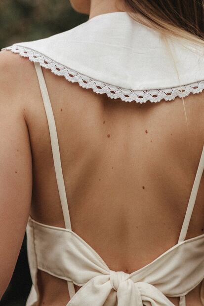 Lunares. Fuente: Pixabay