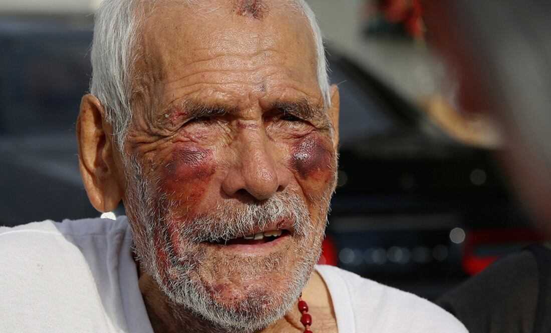 The victim, 91-year-old Rodolfo Rodríguez, was attacked during his daily walk in Willowbrook, in southern Los Angeles - Photo: File photo/EL UNIVERSAL