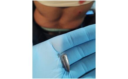 Bala perdida por celebraciones de año nuevo lesiona a 4 en Sonora